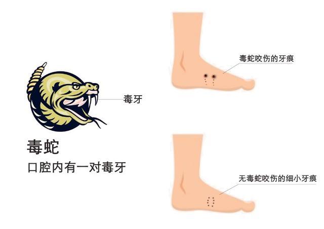 看电视剧中毒太深!