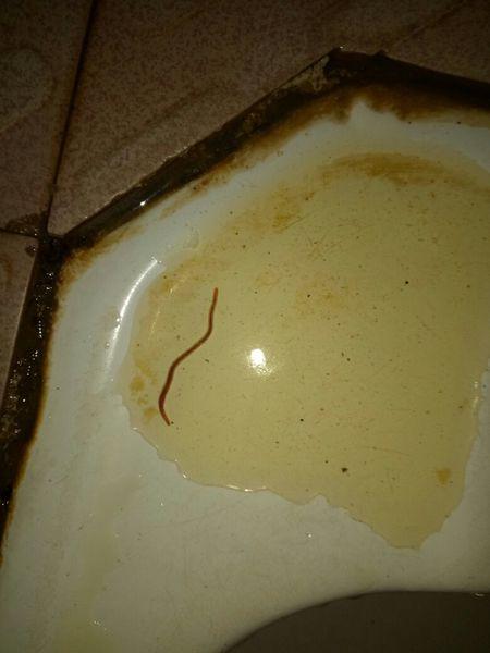 尿 男士 尿出一条红色的虫子 头像吸盘 2--3cm长 还蠕动 本人身体没