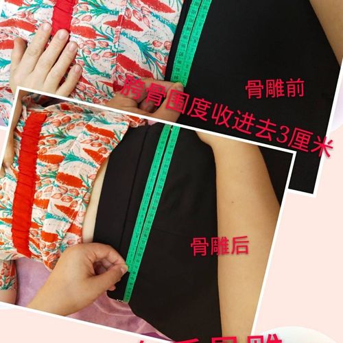 【车氏骨雕】骨盆修复第一次,胯骨围度和股骨头大转子(假胯宽)围度各