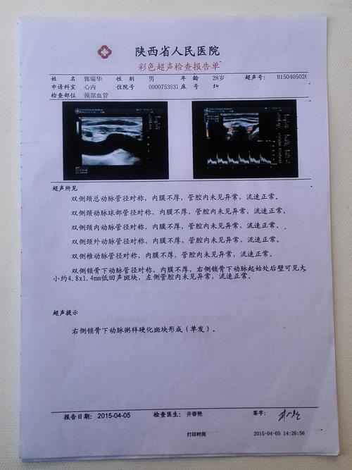 该检查为血管超声检查,根据体表大动脉内动脉硬化程度,评估罹患冠状