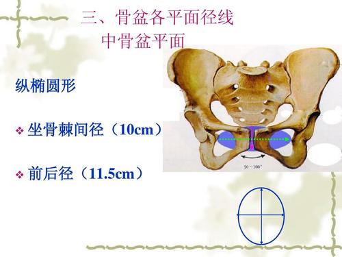 三,骨盆各平面径线 中骨盆平面 纵椭圆形   坐骨棘间径(10cm) 前后径