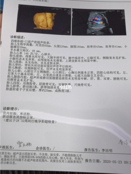 24周   四维 一次过啦_胎儿_四维彩超_胸部_胎盘_妊娠