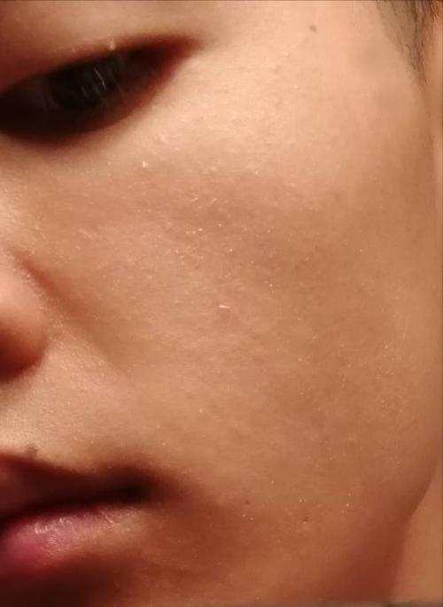这个脸上 好多死皮 还有些白色的皮皮 皮屑,就像没洗脸一样 但是洗脸