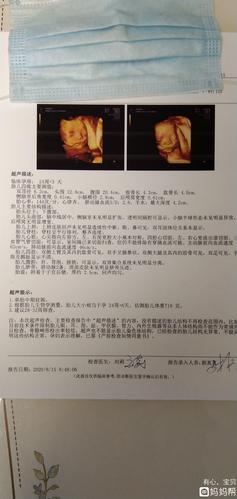 我的小宝四维彩超,看看这是男生还是女生?