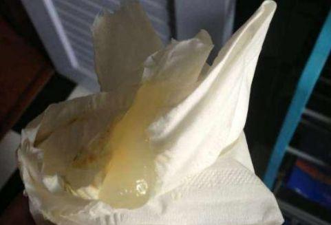 孕晚期总流水,是羊水破了吗?还可能是漏尿,白带,宫颈粘液栓