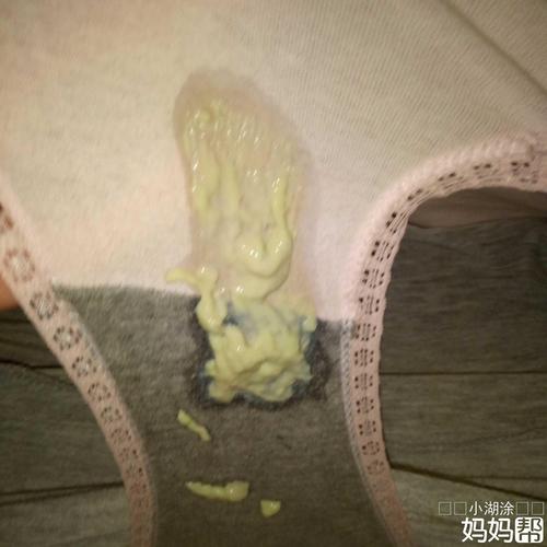 突然流出好多分泌物