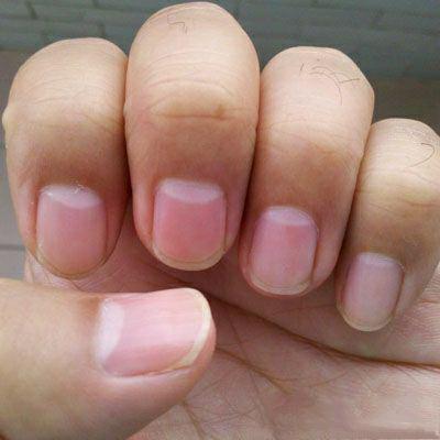 手指甲有白月牙代表什么 手指甲空了是什么原因