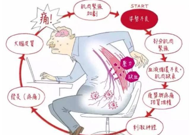 肌肉筋膜炎又称"腰背肌损伤","腰背部纤维组织炎","腰背筋膜疼痛