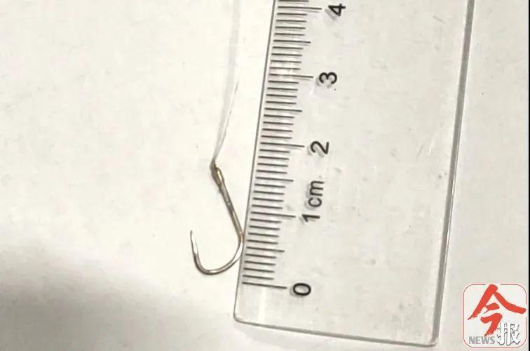 紧急救治!柳州七旬老人误吞鱼钩,离主动脉弓仅一厘米左右!