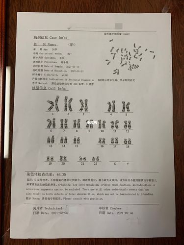 羊水穿刺检测报告可以看得出男女吗 (898961640961_疫苗