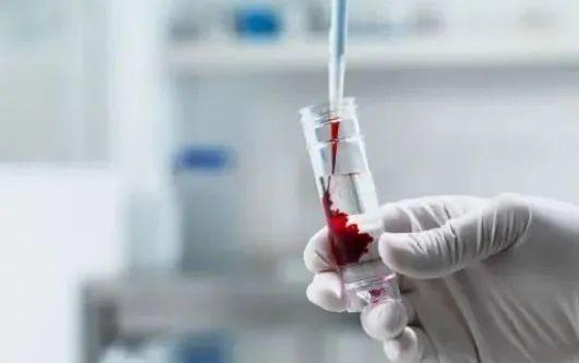 为什么越来越多人得白血病?无非是没逃过这5个"祸首"