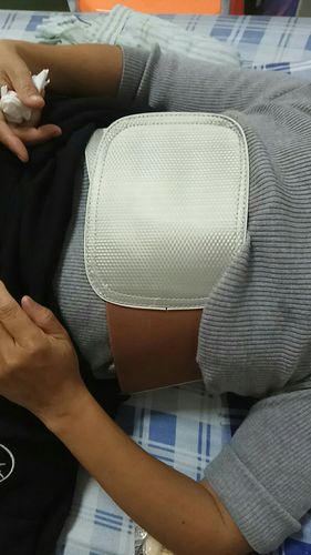 胸口固定绑带