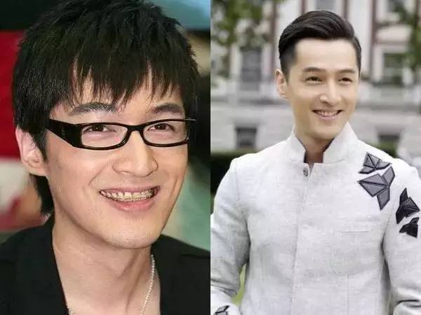 在隐形牙套出现之前,大部分明星用的还是自锁牙套,也就是所谓的"钢牙"