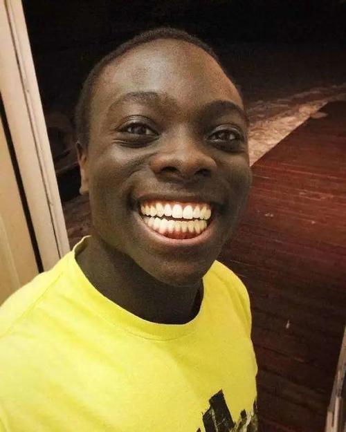 黑人天生还是白牙齿呢,是不是也要把他染黑?