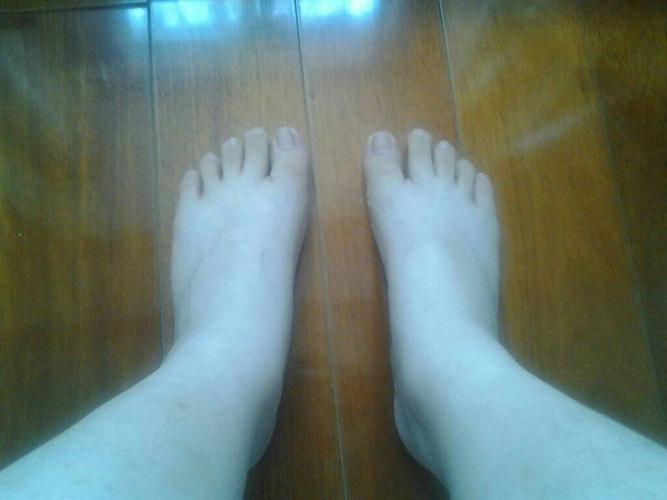 男13岁,身高175cm,脚很大,穿42和43码的鞋子,正常吗?