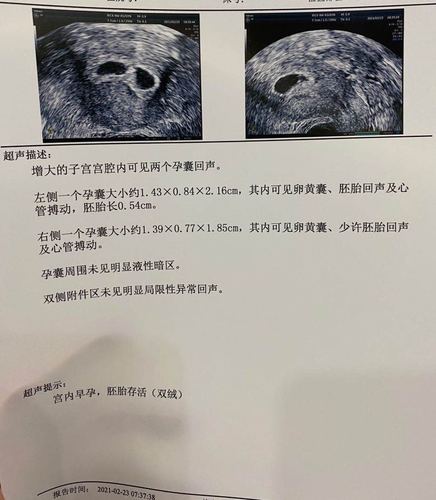 孕囊偏小怎么办呀. 有没有小姐姐支支招呀.