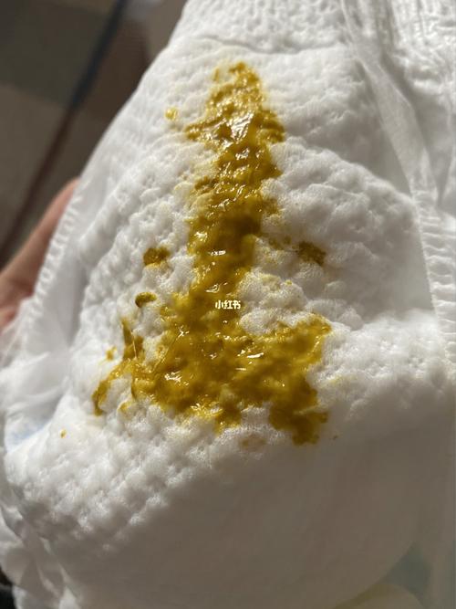 母乳腹泻,有粑粑图,慎入_母乳_腹泻_母乳喂养_母乳性腹泻_母婴_育儿