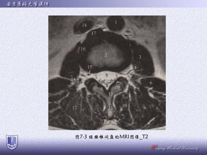 医学院校  本硕连读  解剖学  断层解剖学  ppt 图7-3 经腰椎间盘的