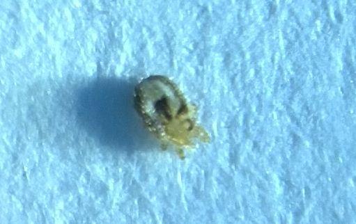 请问图片中的是虱子吗,是哪一个种类?