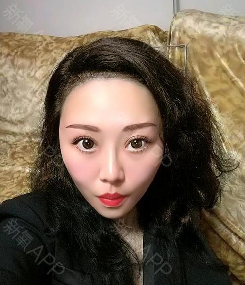 半永久纹发际线