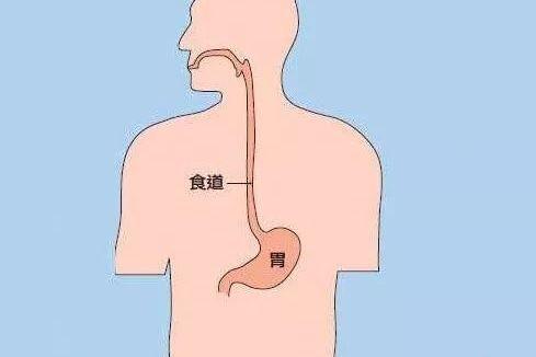 【武汉胃肠医院病案实录】酒足饭饱"葛优躺",巴雷特食管找上门