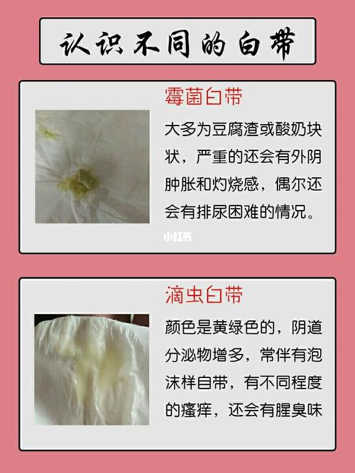 原本透明无味的白带,就会变成豆腐渣状,块状,黄色,绿色等等的情况