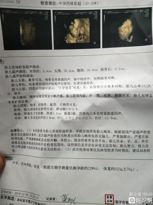 各位亲看看我刚做的四维彩超,能看出是男宝