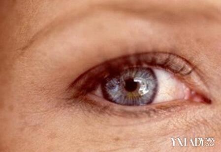 【图】眼睛周围长斑原因是什么 6种祛斑方法帮你重拾美丽肌肤