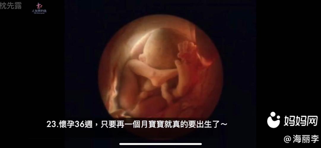 图二这是22周的b超图,是从胎儿屁股背后拍的很明显吧 ,.