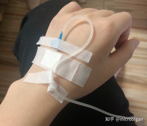 若通过饮水及食物补充的水量无法达标,应及时就诊,必要时通过静脉