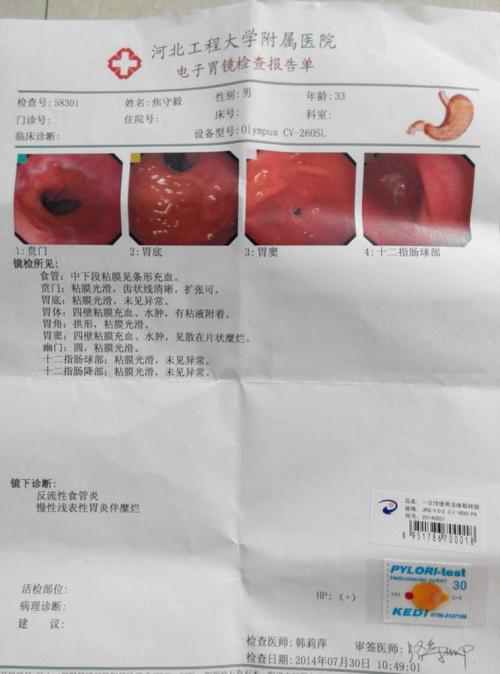 什么药治疗胃糜烂好啊?