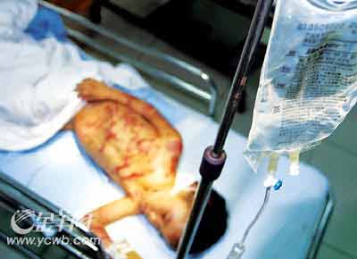 5岁幼童惨遭生母毒打 耳朵快拧下阴囊破裂(图)