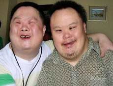 否多发人群:婴幼儿传播途径:否传染性:否其他名称:先天愚型英文名