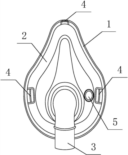 一种带鼻饲管通道的无创呼吸面罩制造技术