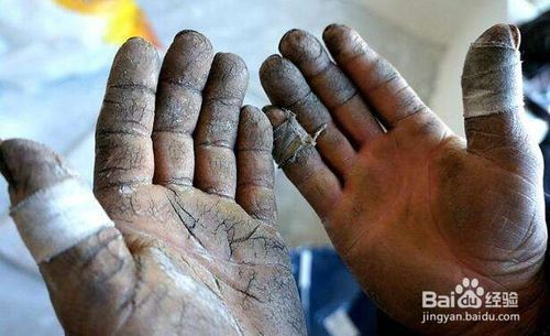 分享春冬季部分人群防止手干裂的经验