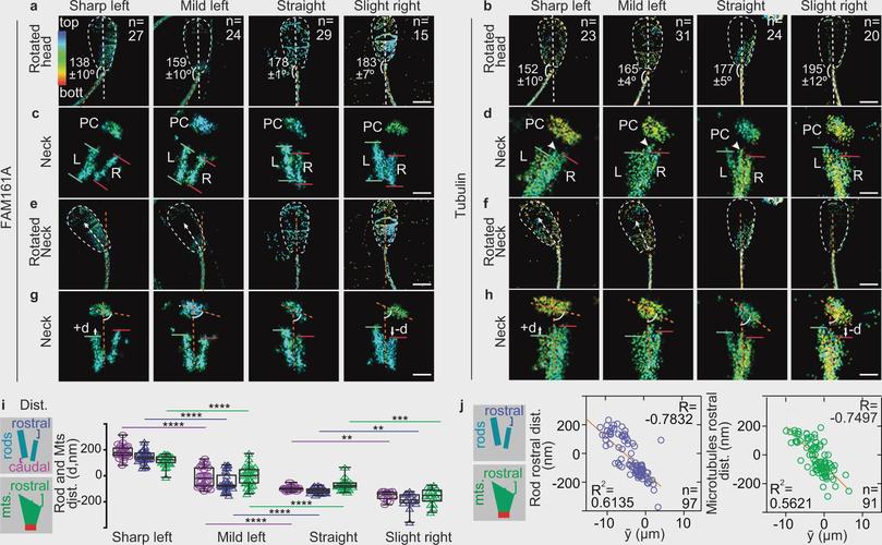 新发现的精子运动形式可以帮助诊断和治疗男性不育症
