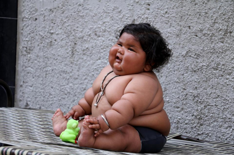 印度1岁女孩因身体过胖,被父母坚称"神童"转世,网友:这是病