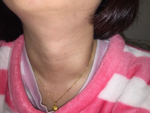 脖子左下方咽口水就会有个包,这两天还比较明显