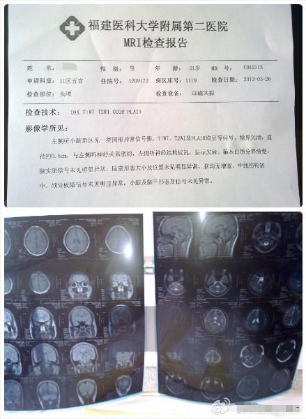 谁会看mri核磁共振检查报告的?