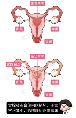 如果你有女儿,请一定要告诉她「无痛人流的真相」,再爱也别犯傻