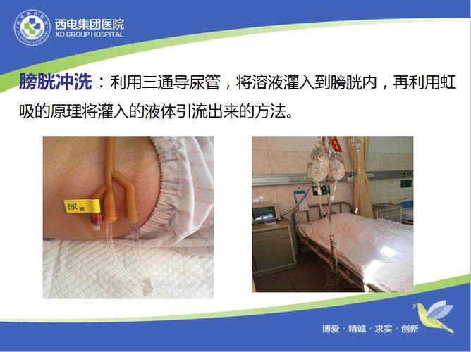 从尿道的解剖特点,导尿术,留置导尿术,膀胱冲洗术,常见问题解答五个
