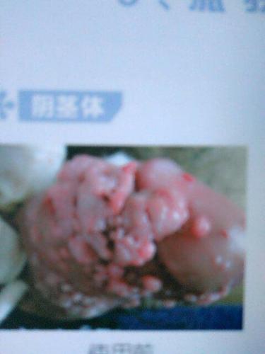 男性感染hpv病毒图片