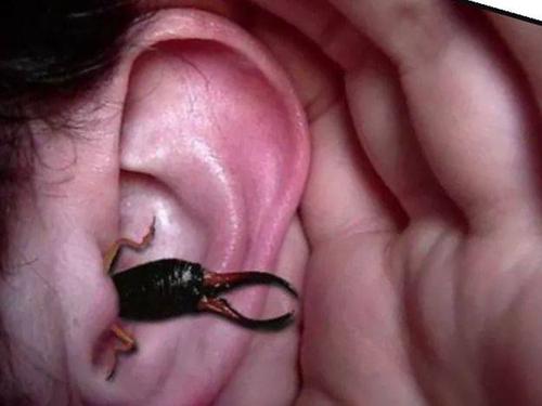 蠼螋真的会钻进耳朵吗?