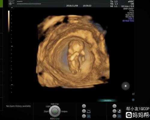 12周的nt 看着像男孩还是女孩