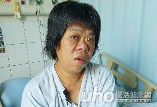 她的脸突然「走山」 竟是肢端肥大症作祟