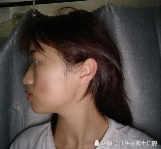 被公认的3种超丑"侧脸",一回头毁掉整张脸,看看是不是你?