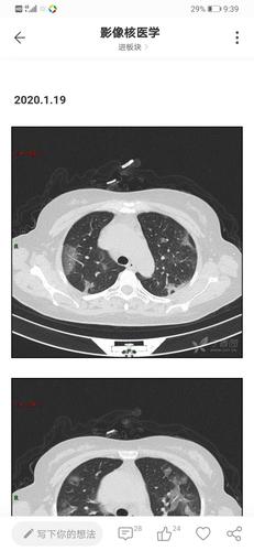 新冠肺炎(来自丁香园))