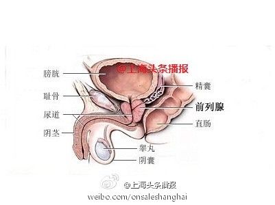 男子约会女网友膀胱被对方男友塞入12米长鼠标线