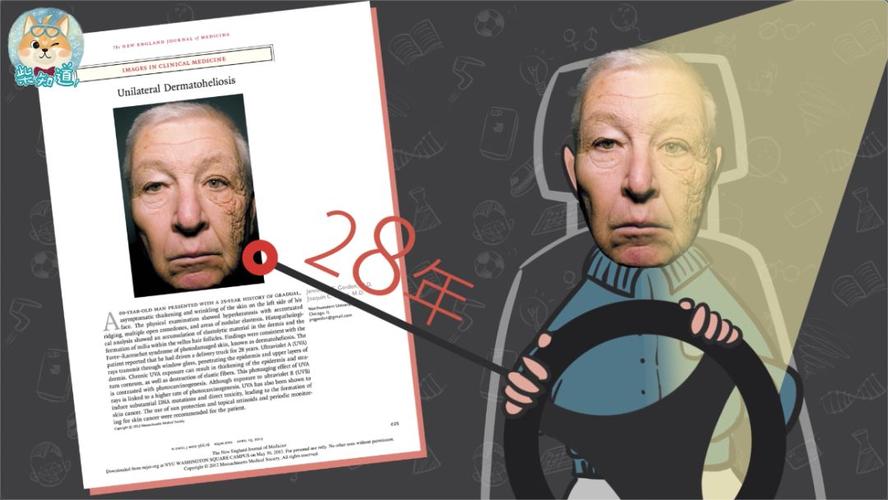 紫外线如何将你慢慢催老?