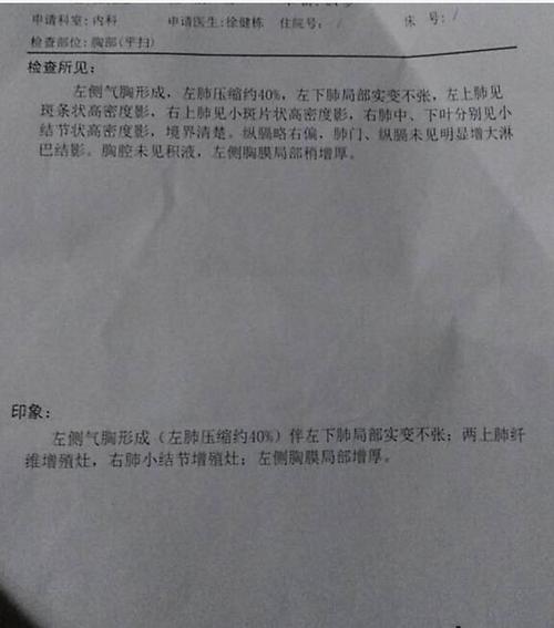 左侧气胸形成伴左下肺局部实变不张,两上肺纤维增殖灶